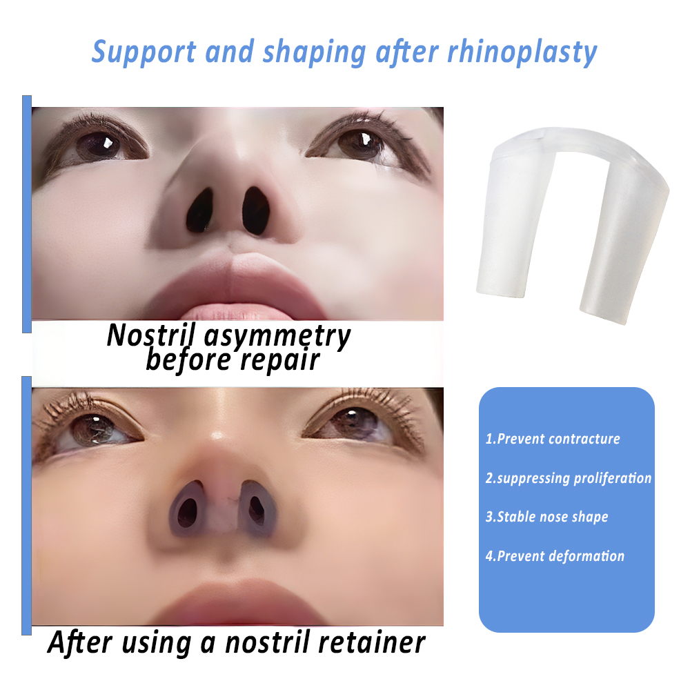 Nasenhalter zur Nasenkorrektur – Anti Snore Contour Pillow Bewertung und Preis