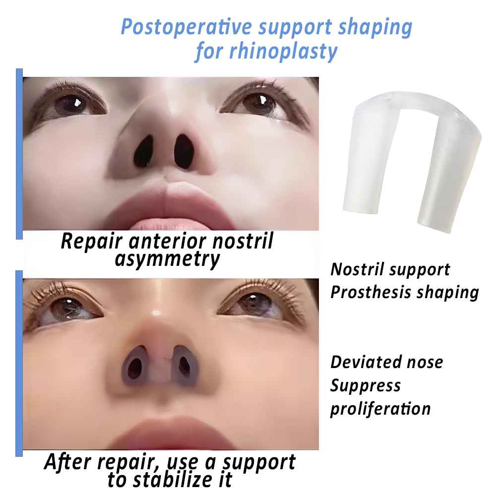 Postoperative Nasenkorrektur-N – Anti Snore Contour Pillow Bewertung und Preis